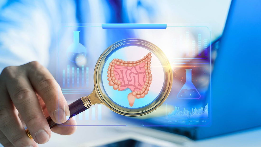 Colitis Ulcerativa Crónica Idiopática: Diagnóstico y Seguimiento