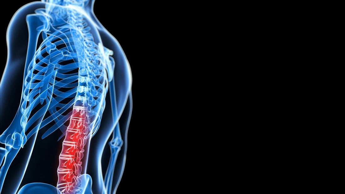 Espondilitis Anquilosante: Enfoque Integral para su Manejo