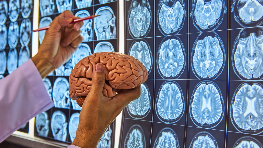 Glioblastoma: Qué es, Causas, Síntomas y Diagnóstico