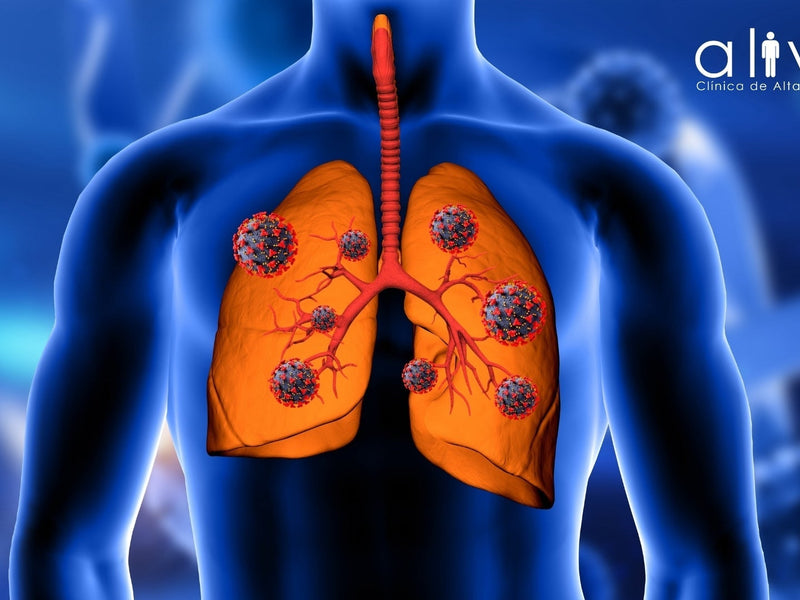 Fibrosis Quística: Desde el Diagnóstico Hasta el Tratamiento Integral