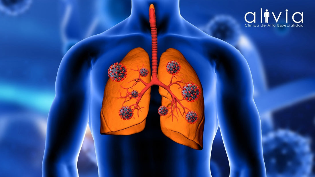 Fibrosis Quística: Desde el Diagnóstico Hasta el Tratamiento Integral