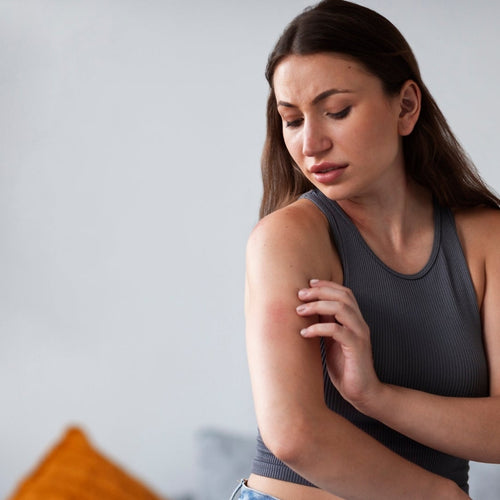 Lupus bajo control, calidad de vida