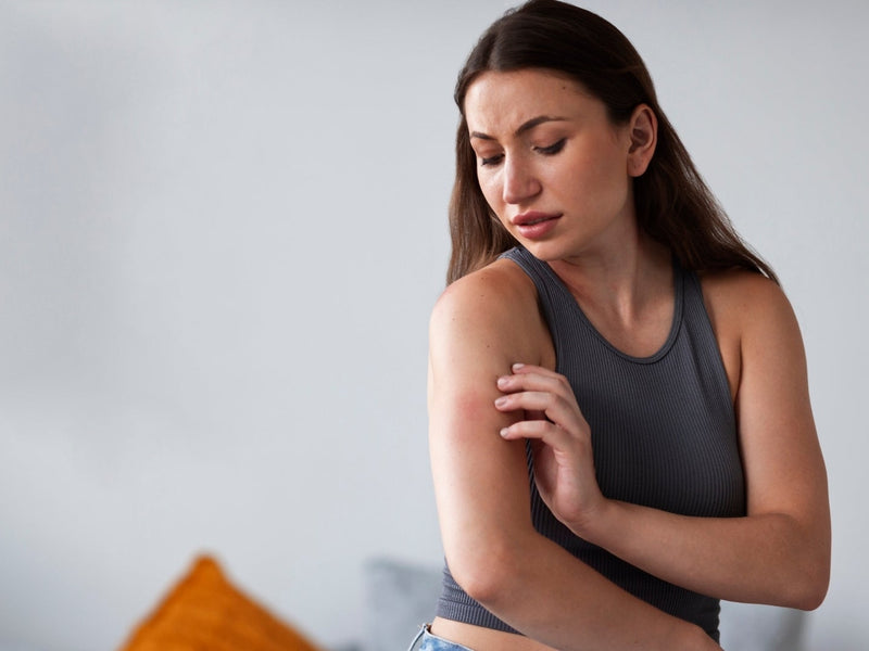 Lupus bajo control, calidad de vida