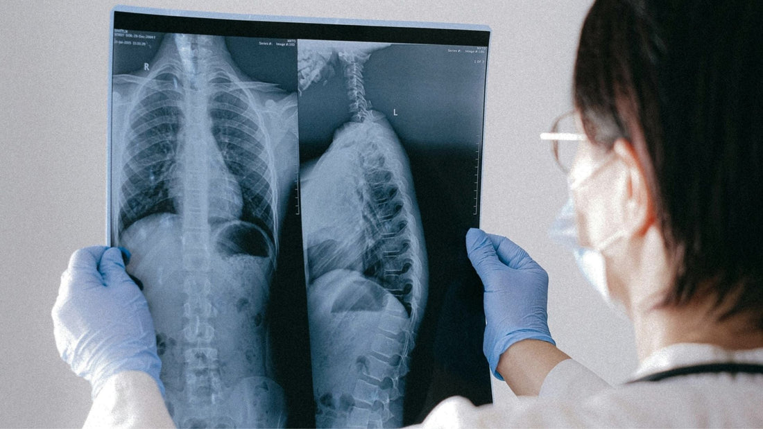 Tuberculosis: Prevenir, Detectar y Curar