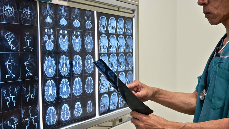 Día Mundial del Neurocirujano: ¿Qué hacer y Cuándo acudir a uno?