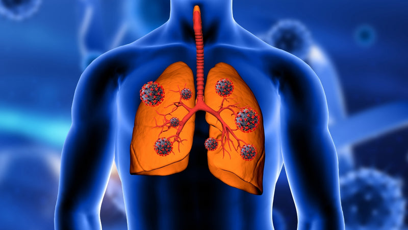 Fibrosis Quística: Desde el Diagnóstico Hasta el Tratamiento Integral