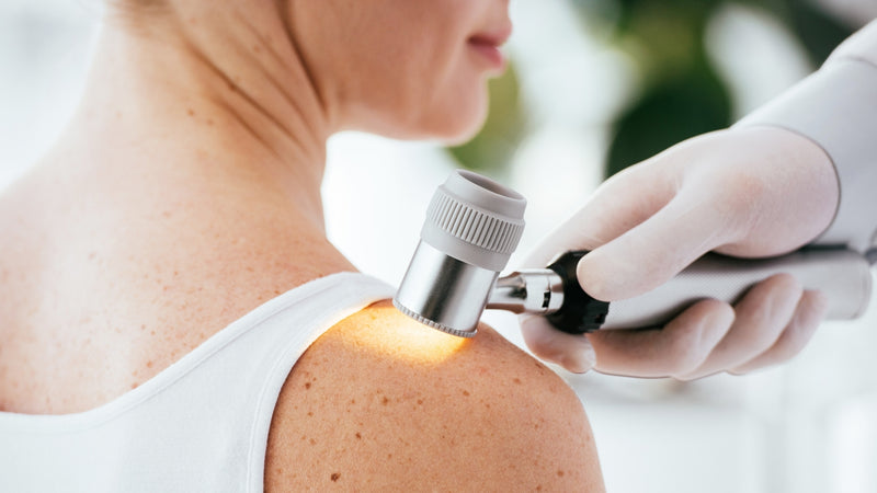 Lupus Eritematoso Sistémico: Síntomas, Tratamiento y Calidad de vida