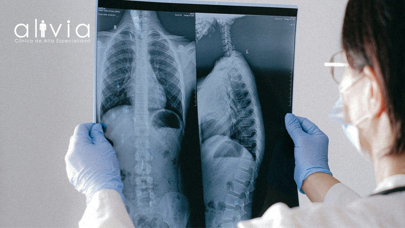 Mesotelioma Pleural: Claves para Comprender su Alcance y Efectos