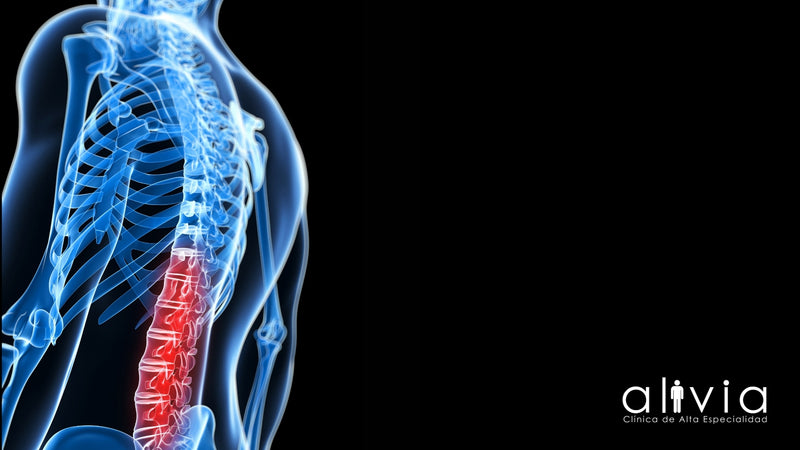 Espondilitis Anquilosante: Un Enfoque Integral para su Manejo