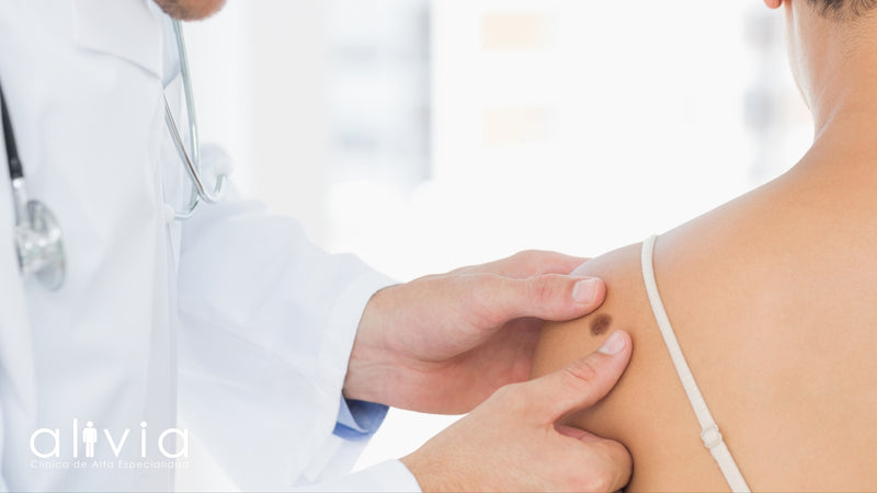 Melanoma Cutáneo: Prevención y Diagnóstico